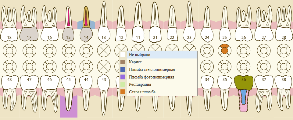 Графическое представление зубной формулы